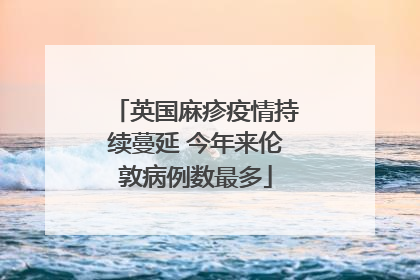 英国麻疹疫情持续蔓延 今年来伦敦病例数最多